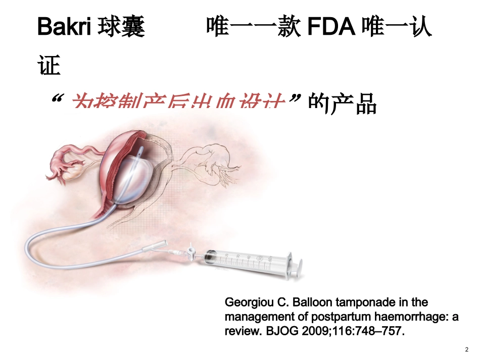 BAKRI子宫填塞球囊导管_第2页