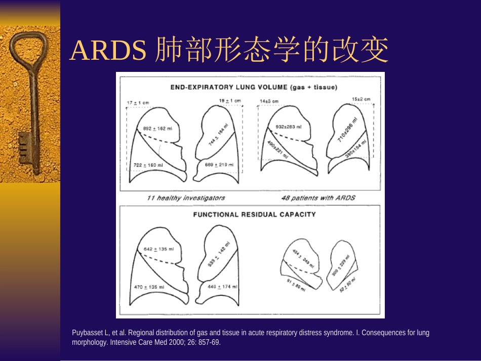 ARDS患者的肺复张-nursing_第3页