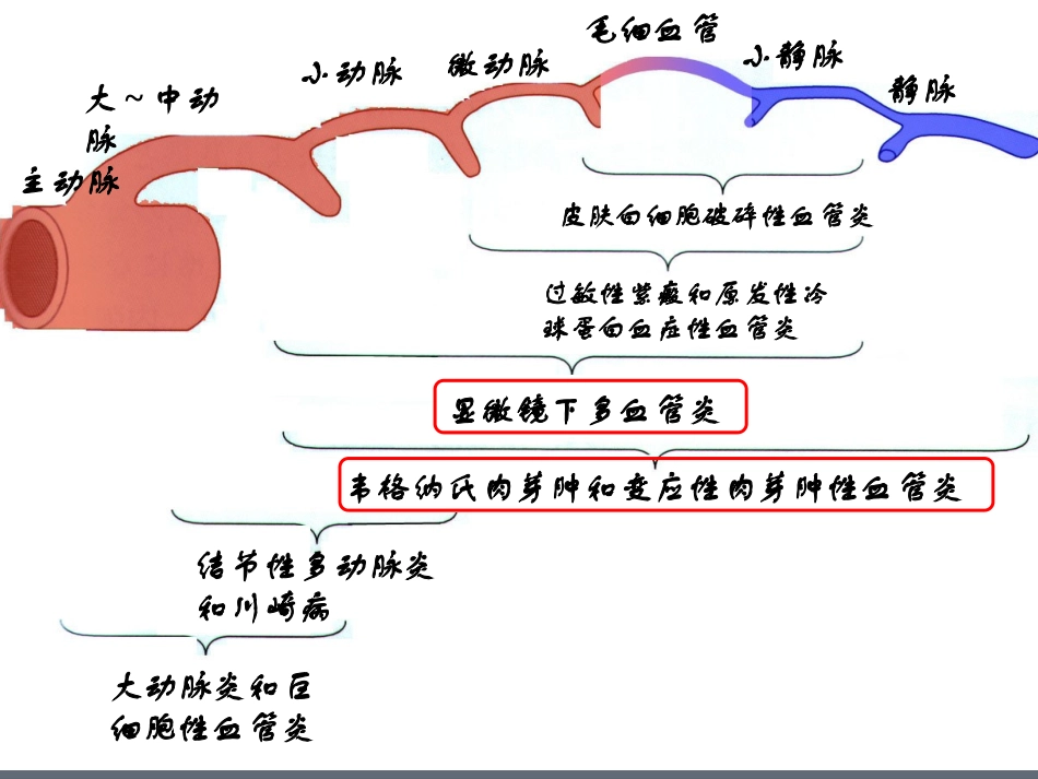 ANCA相关性小血管炎-_第3页