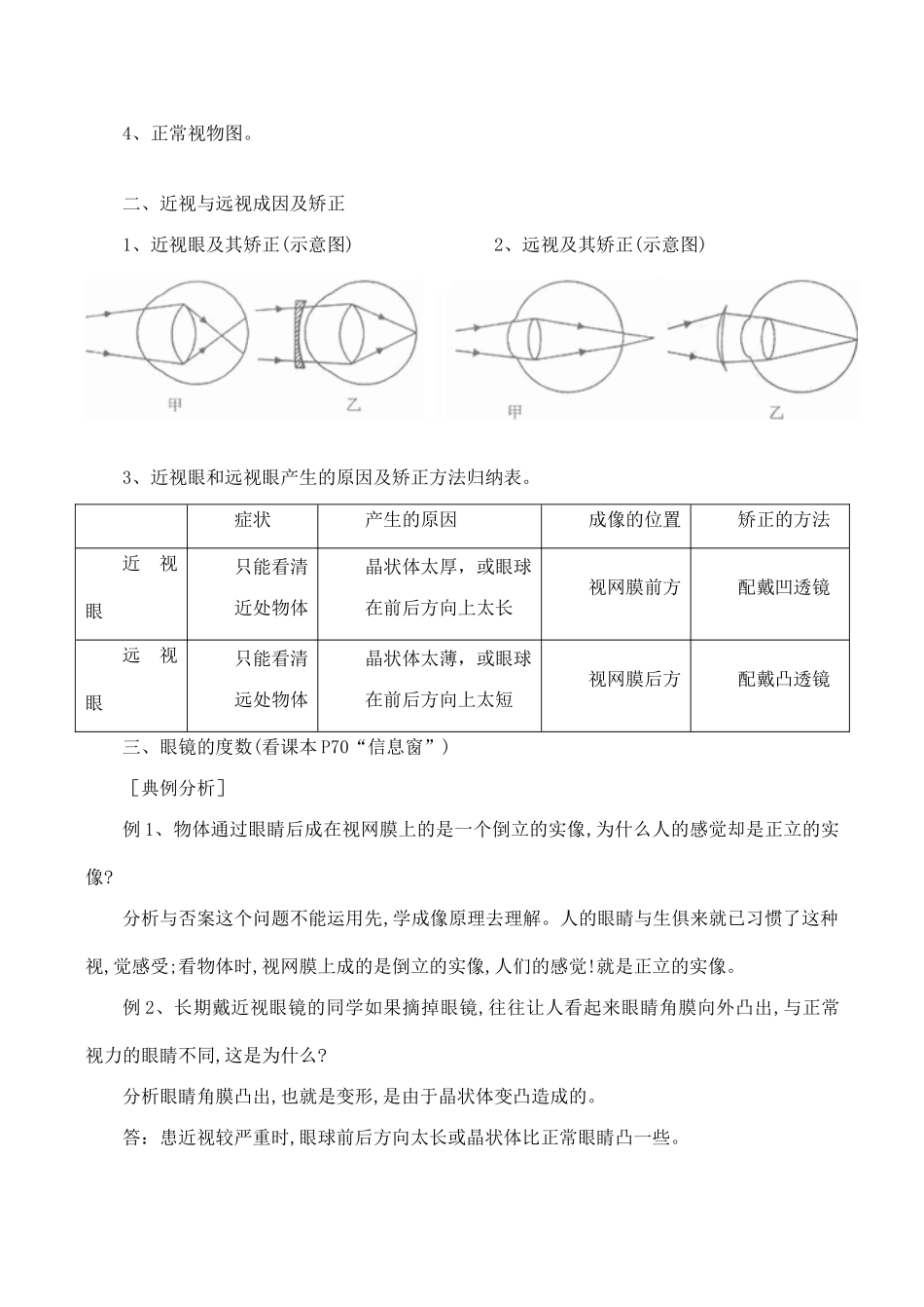 八年级物理眼睛与视力矫正 4沪科版_第2页