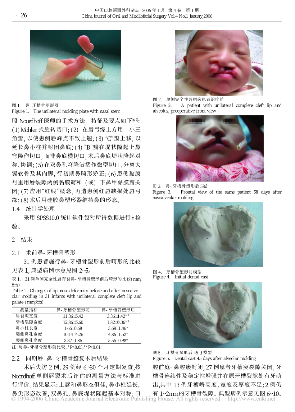 单侧唇腭裂鼻-牙槽骨塑形后同期唇-鼻-牙槽骨整复术_第3页