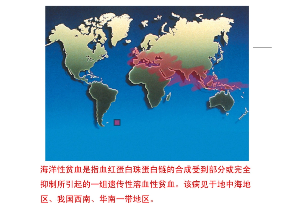 地贫内分泌并发症_第2页
