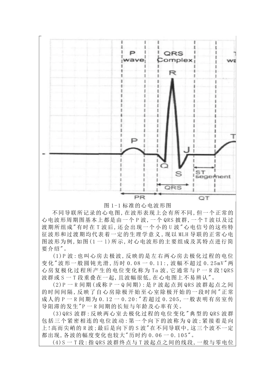 matlab心电信号R波检测_第2页