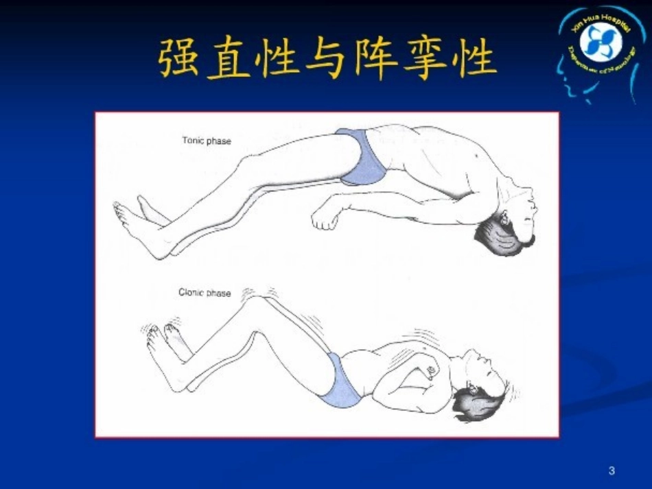 抽搐与惊厥ppt_第3页