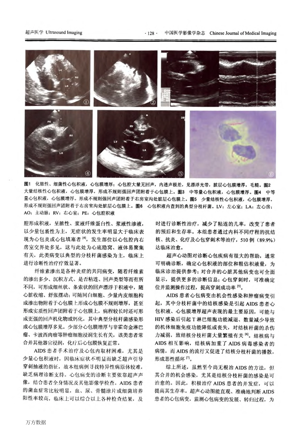 艾滋病心包疾病的超声心动图评价_第3页