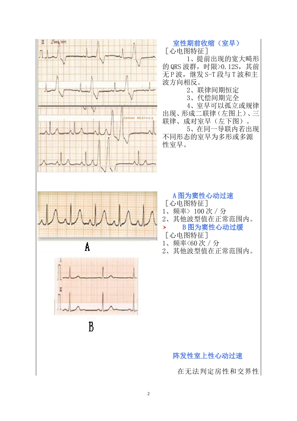 常见心电图诊断图谱_第2页