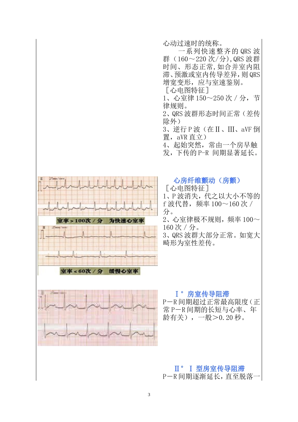 常见心电图诊断图谱_第3页