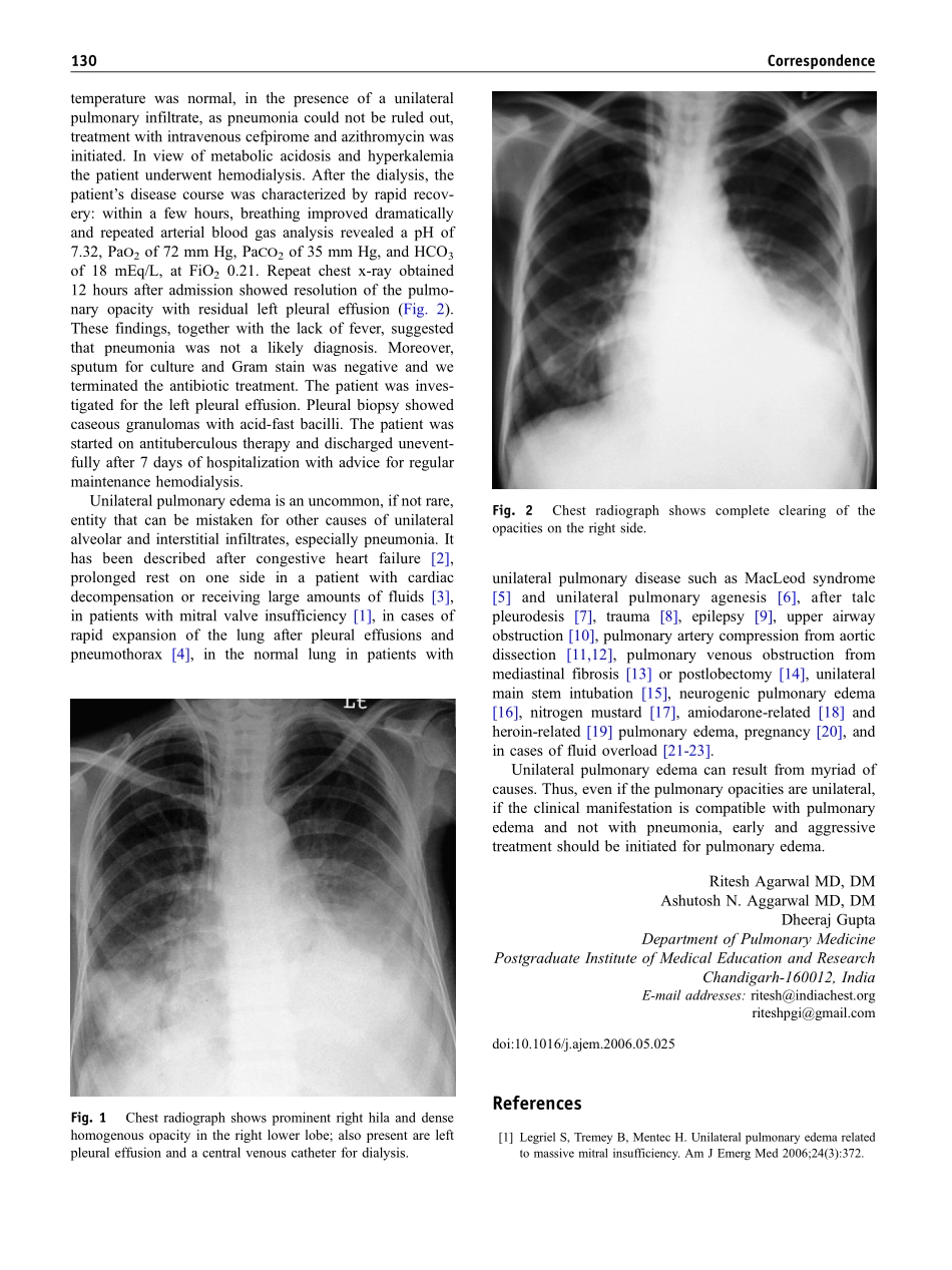 单侧肺水肿的原因_第2页