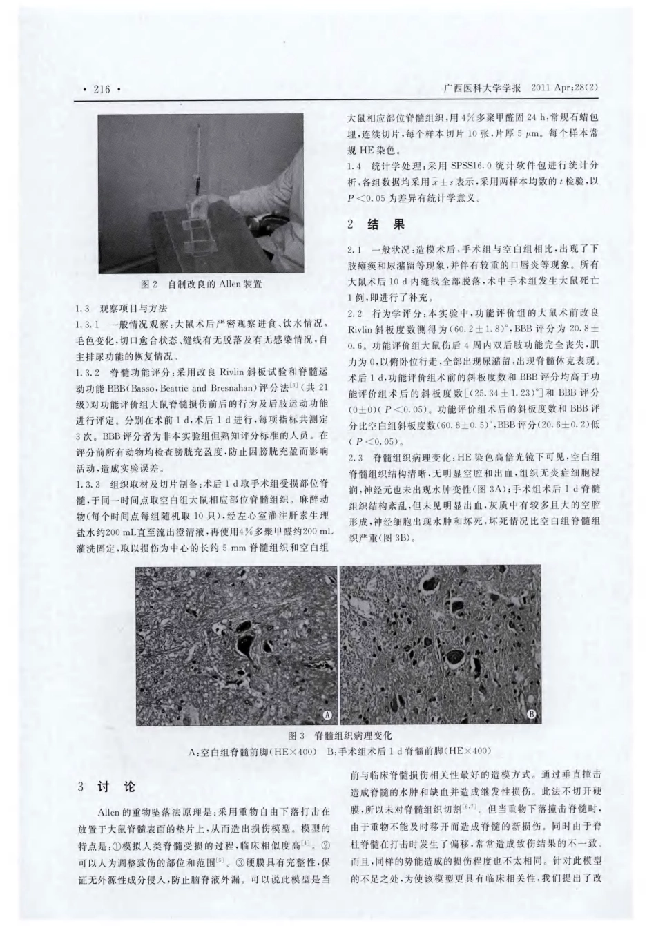 大鼠Allen’s脊髓损伤模型的建立及评价_第2页