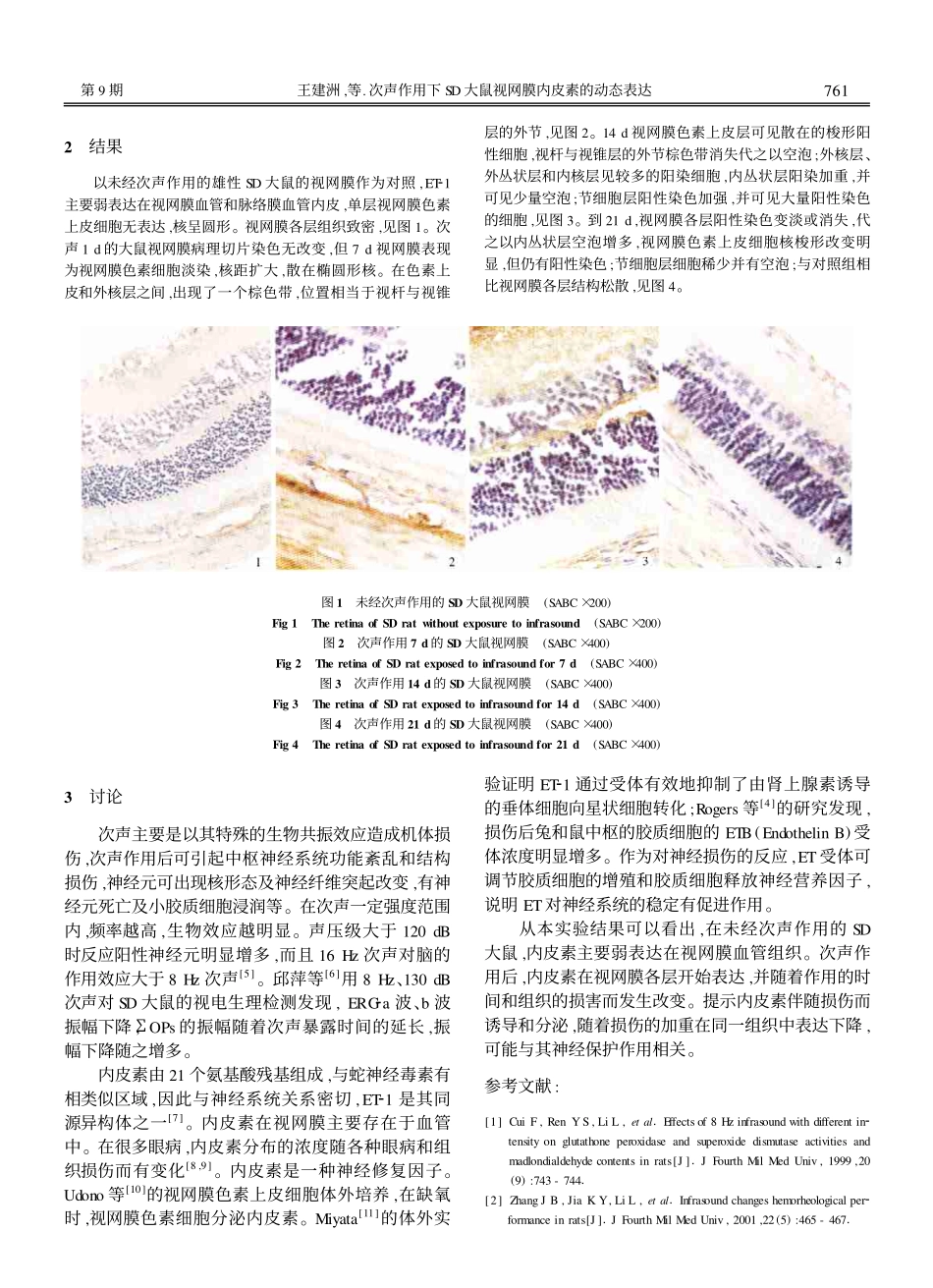 次声作用下SD大鼠视网膜内皮素的动态表达_第2页
