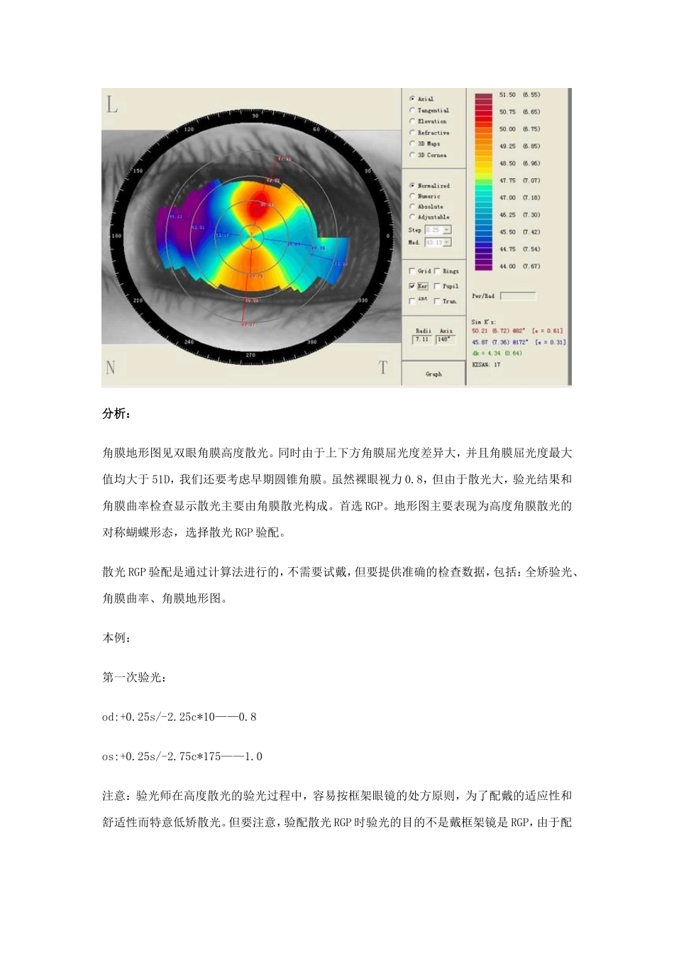 案例说明散光RGP验配要点_第2页