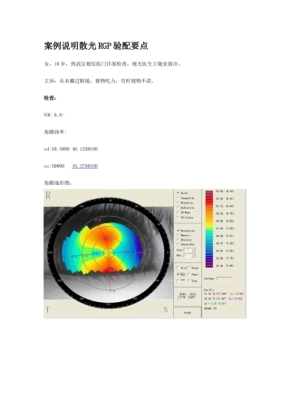 案例说明散光RGP验配要点