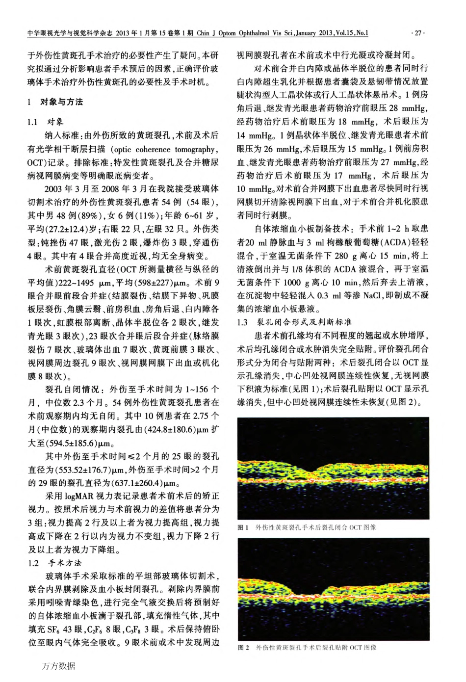 玻璃体手术治疗外伤性黄斑裂孔的预后及影响因素_第2页