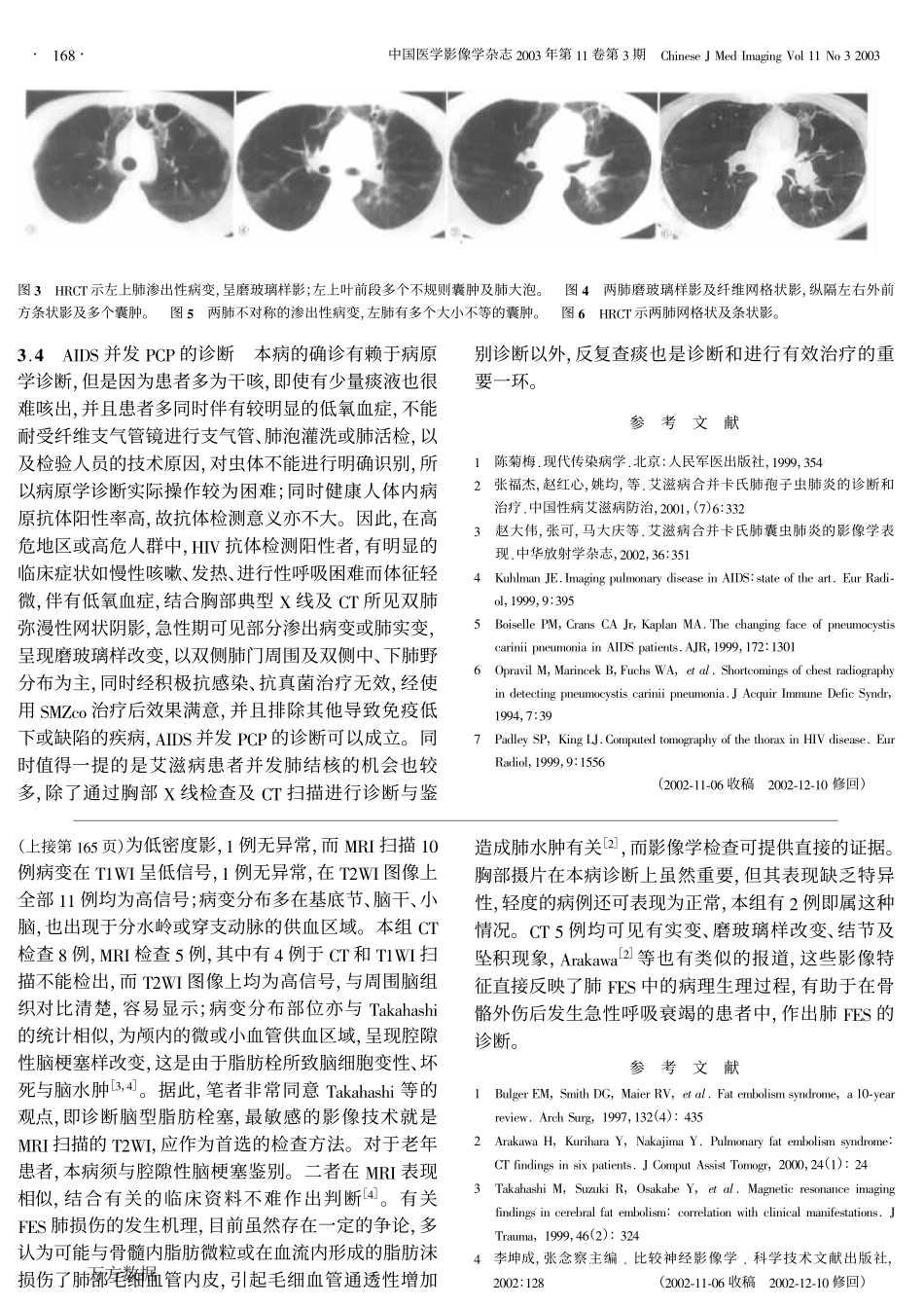 艾滋病并发卡氏肺孢子虫肺炎的X线和CT诊断_第3页