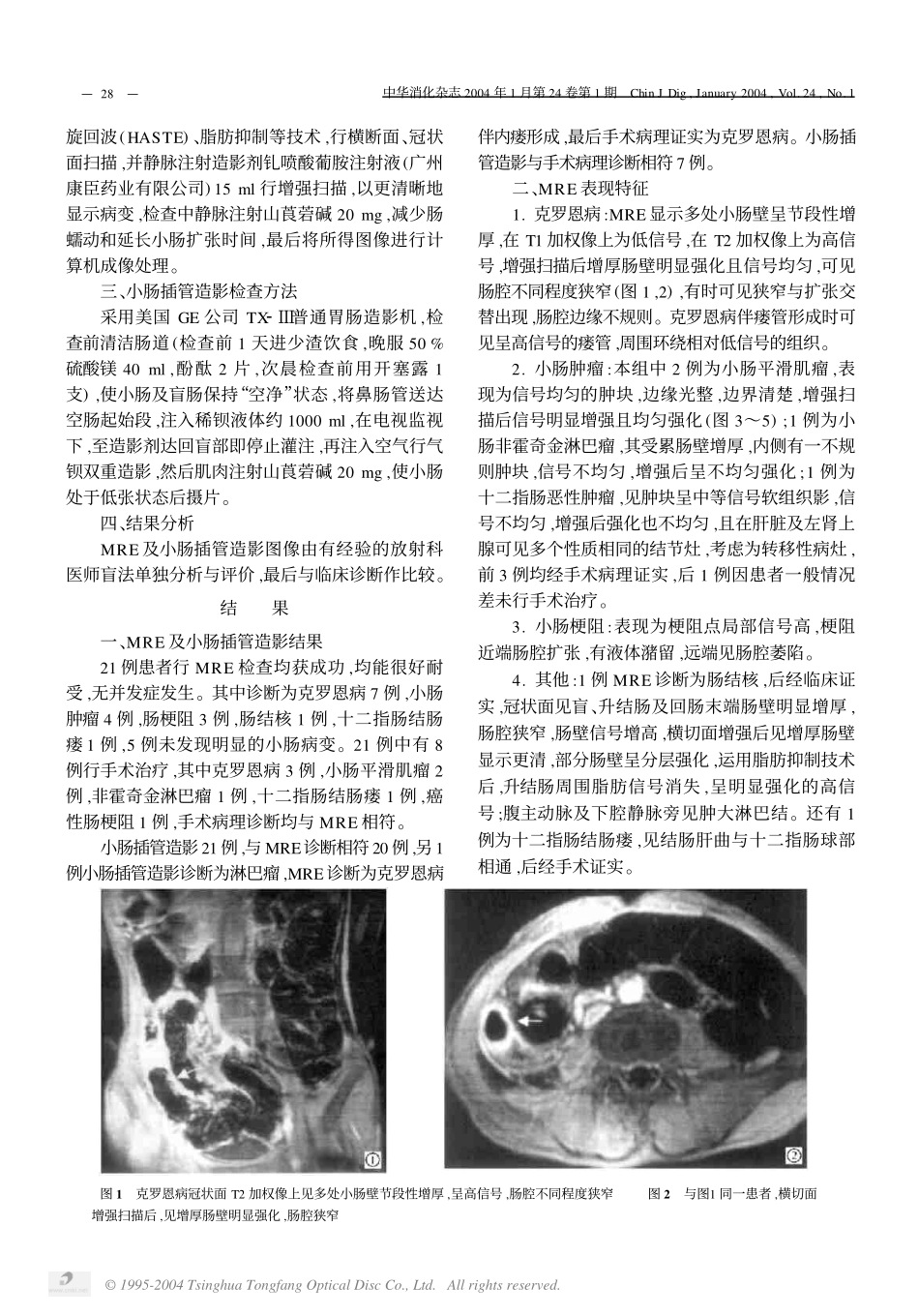 磁共振小肠造影对小肠疾病的诊断价值_第2页