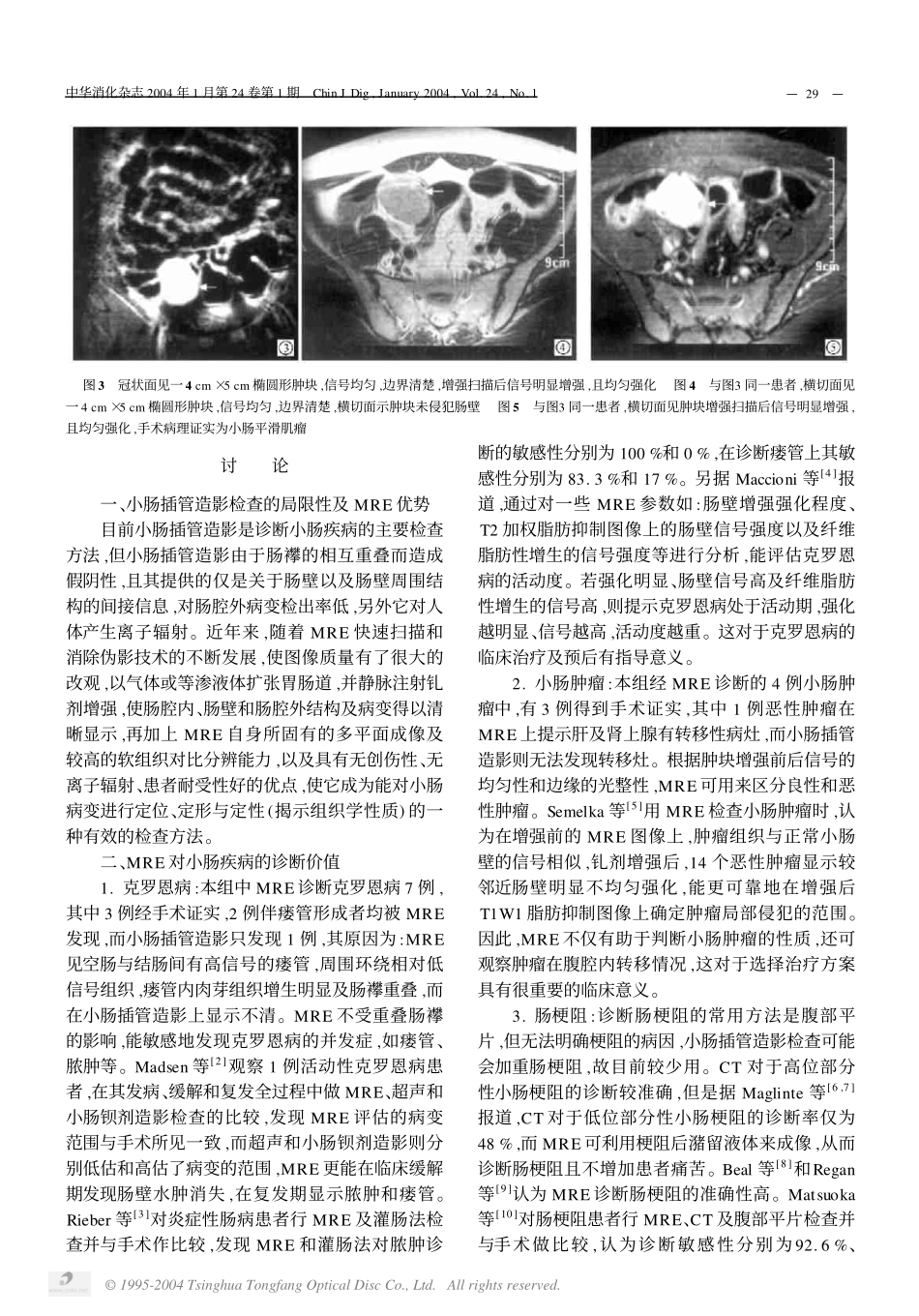 磁共振小肠造影对小肠疾病的诊断价值_第3页