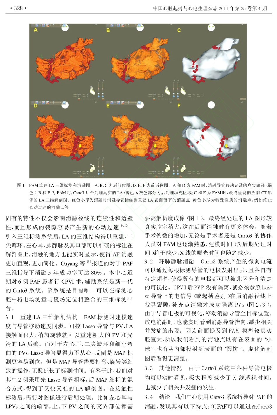 Carto3系统指导下经导管射频消融阵发性心房颤动的初步体验_第3页