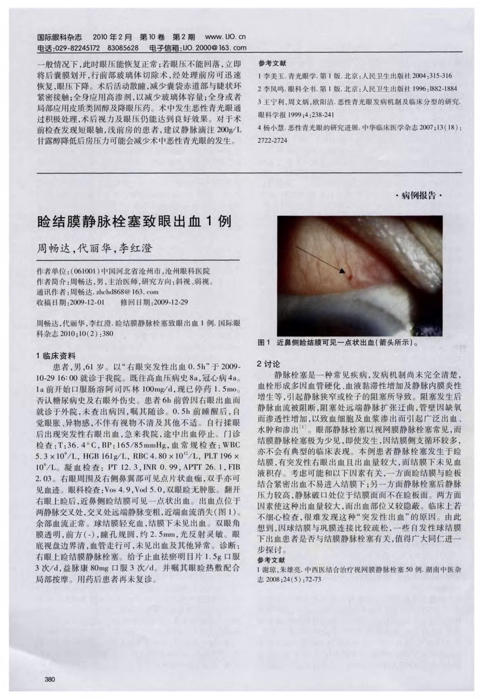 白内障超声乳化术中并发恶性青光眼的处理与观察_第3页
