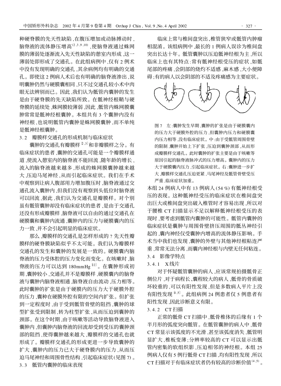 骶管内囊肿的诊断及其发生机制的探讨_第3页