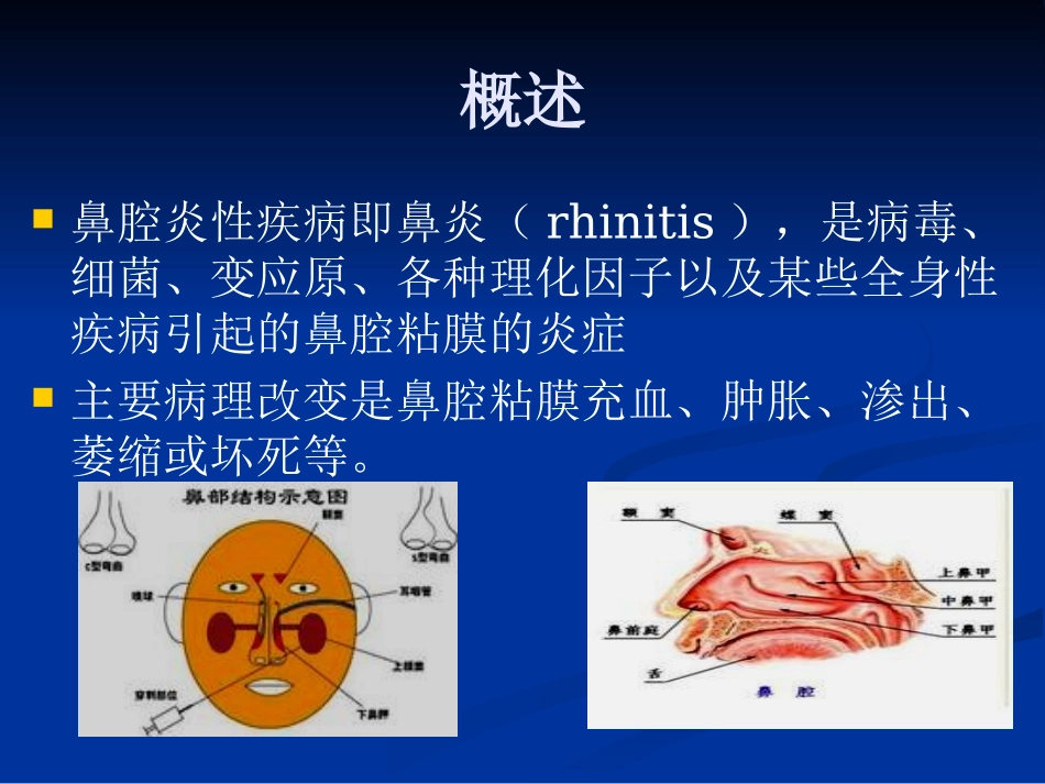 鼻腔炎性疾病_第2页