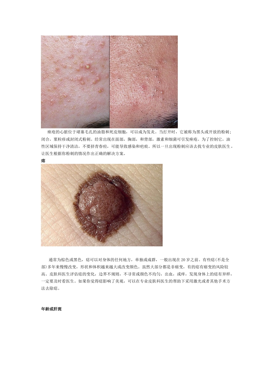 常见的皮肤问题_第2页