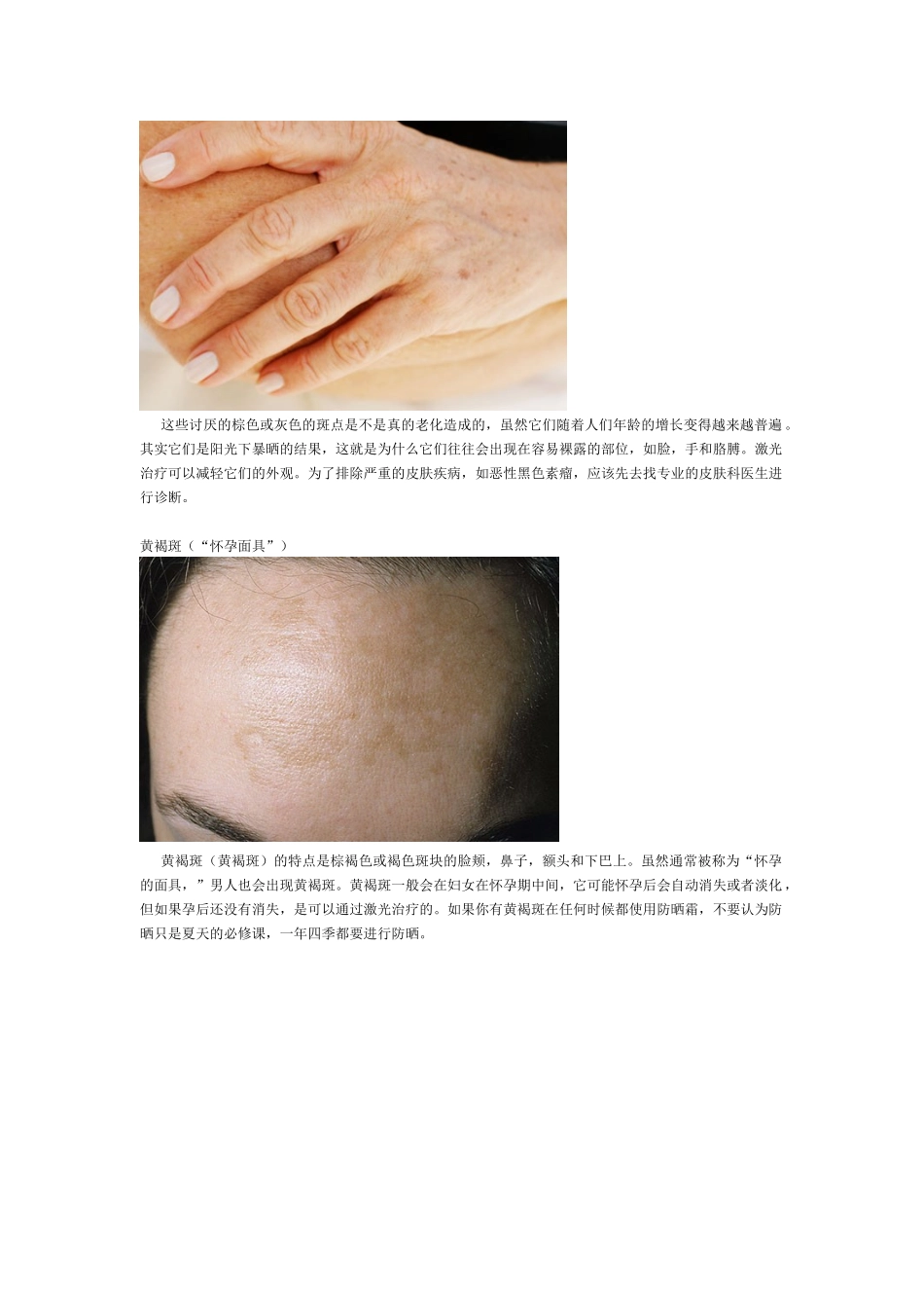 常见的皮肤问题_第3页