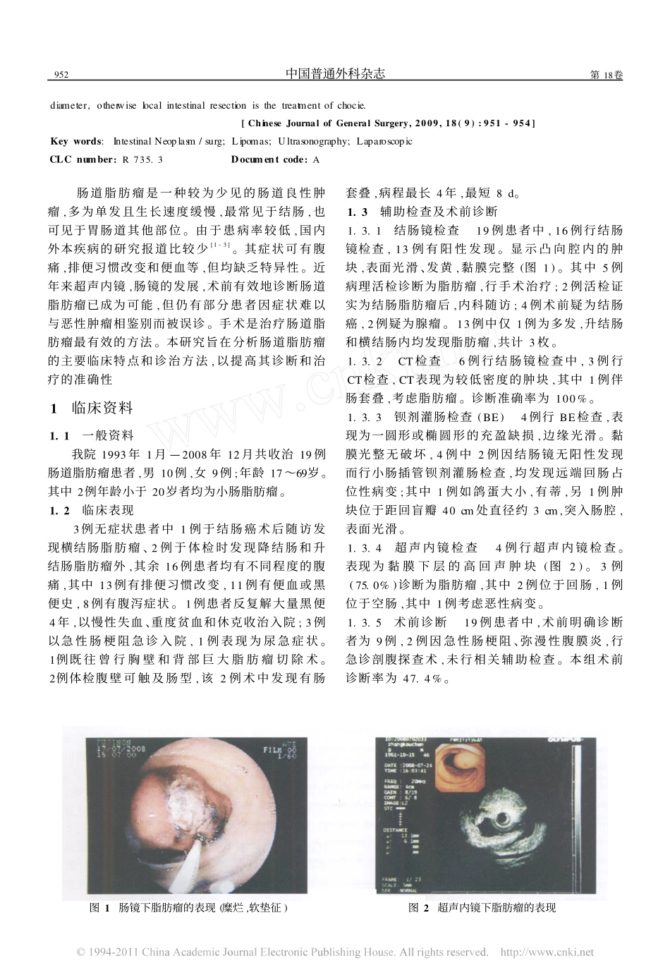 肠道脂肪瘤诊治的体会_第2页