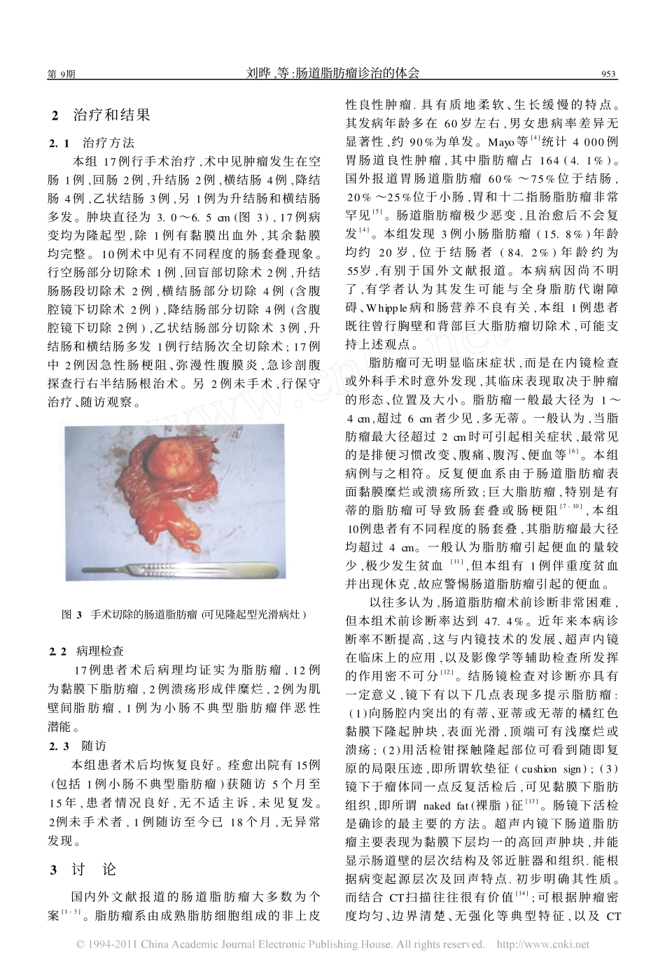 肠道脂肪瘤诊治的体会_第3页