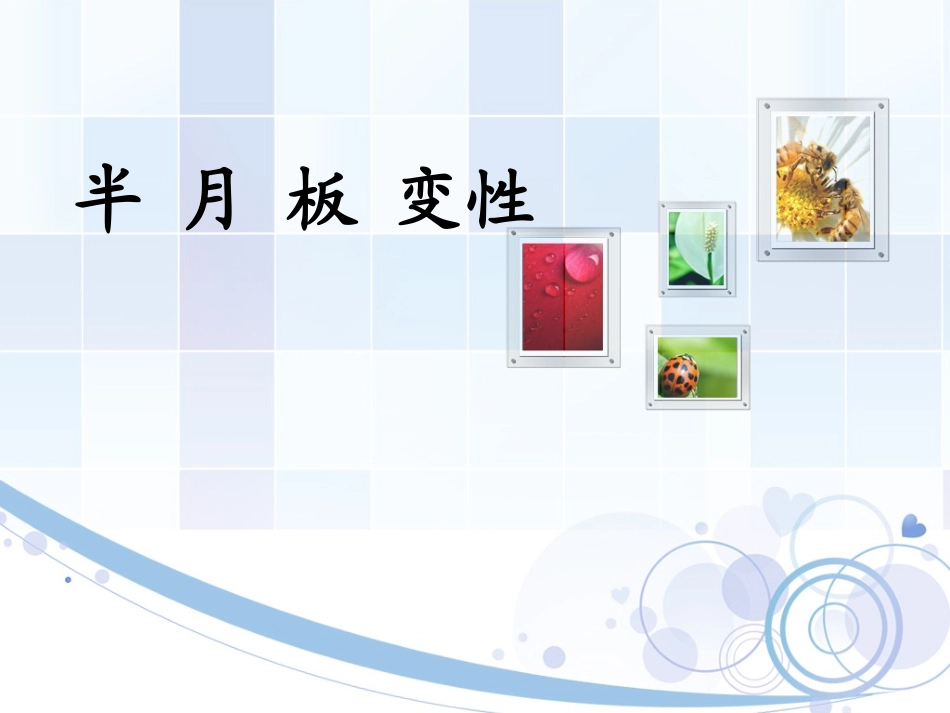 半月板变性1_第1页
