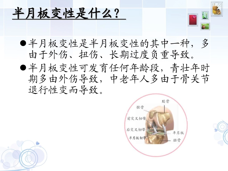 半月板变性1_第2页