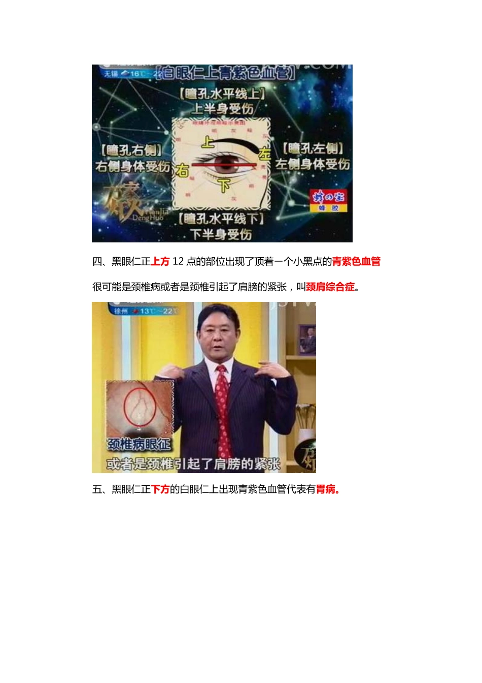 常见眼疾防治法_第2页