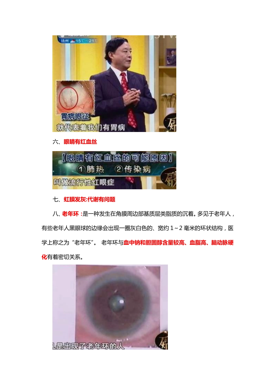 常见眼疾防治法_第3页