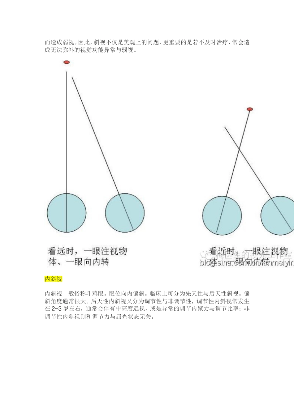 【视光】斜视、隐斜视与验光配镜的关系_第2页