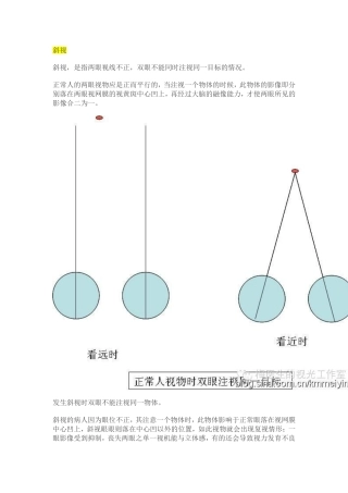 【视光】斜视、隐斜视与验光配镜的关系