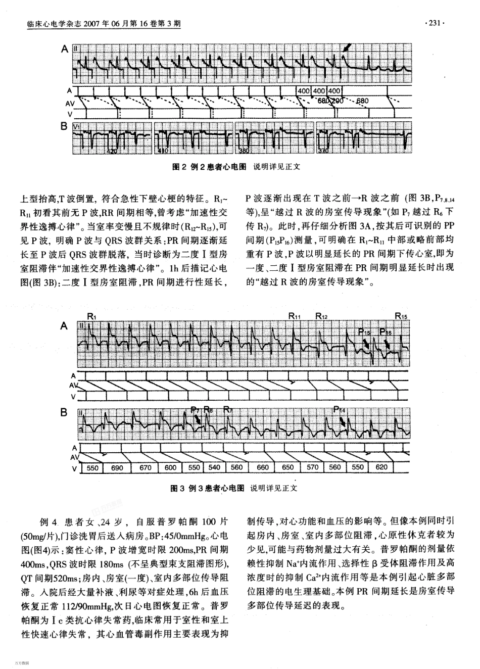 PR间期精读_第2页