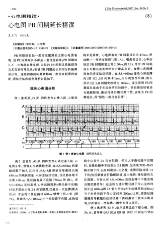 PR间期精读