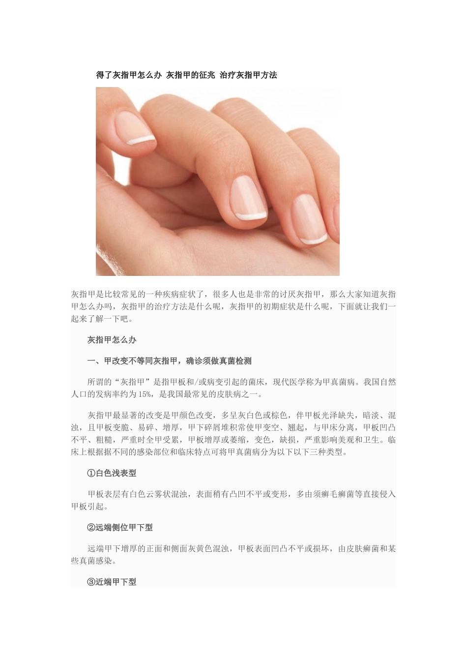 得了灰指甲怎么办 灰指甲的征兆 治疗灰指甲方法_第1页