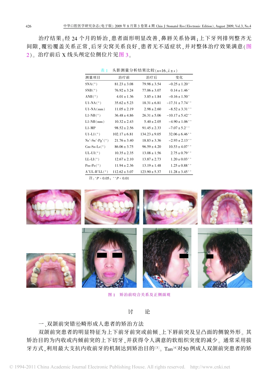 成人双颌前突错畸形患者拔牙正畸治疗后颅面软硬组织的变化_林铭_第3页