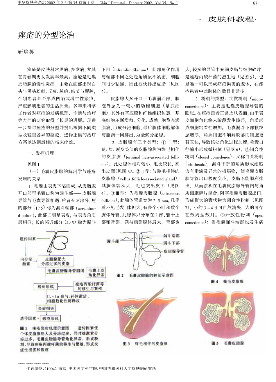 痤疮的分型论治_第1页