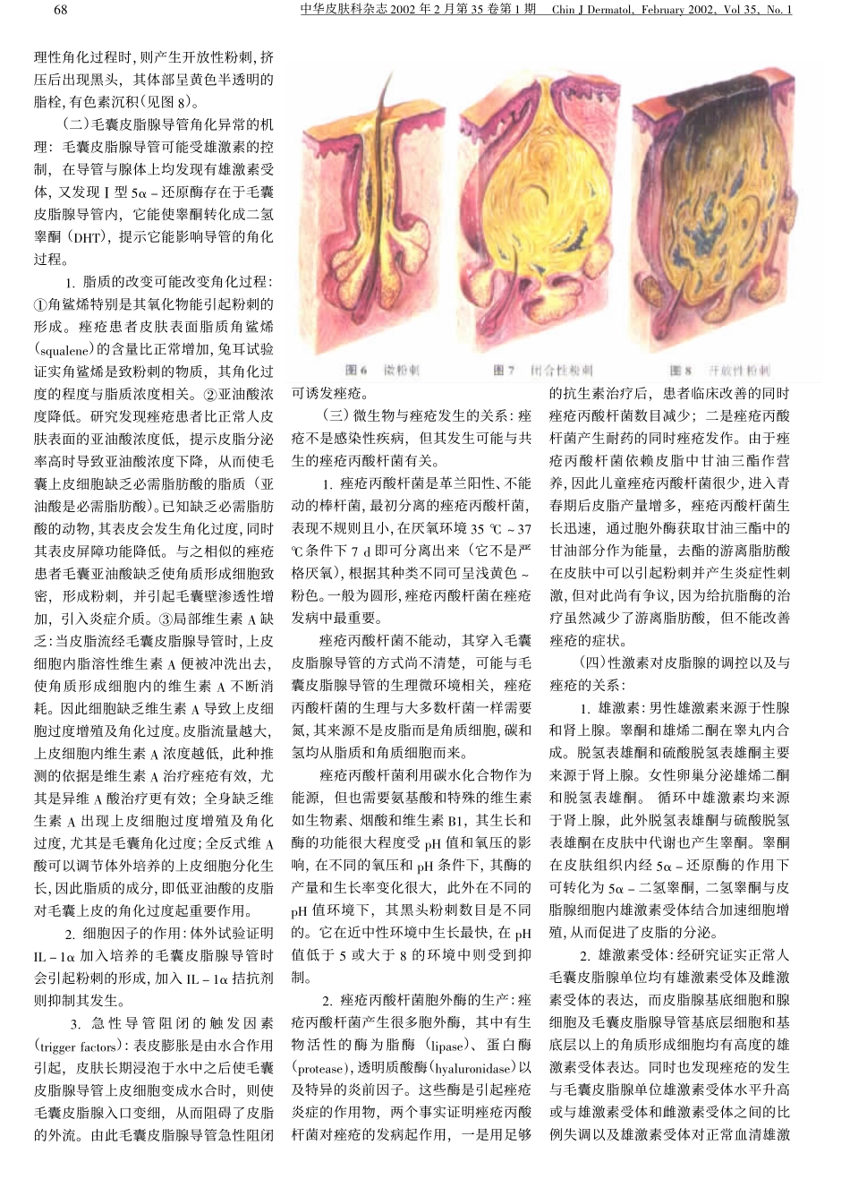 痤疮的分型论治_第2页