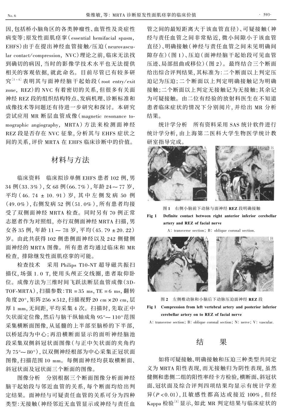 the mrta 诊断原发性面肌痉挛的临床价值guide download_第2页