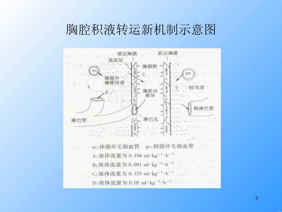 20050523 胸腔积液鉴别诊断_第3页