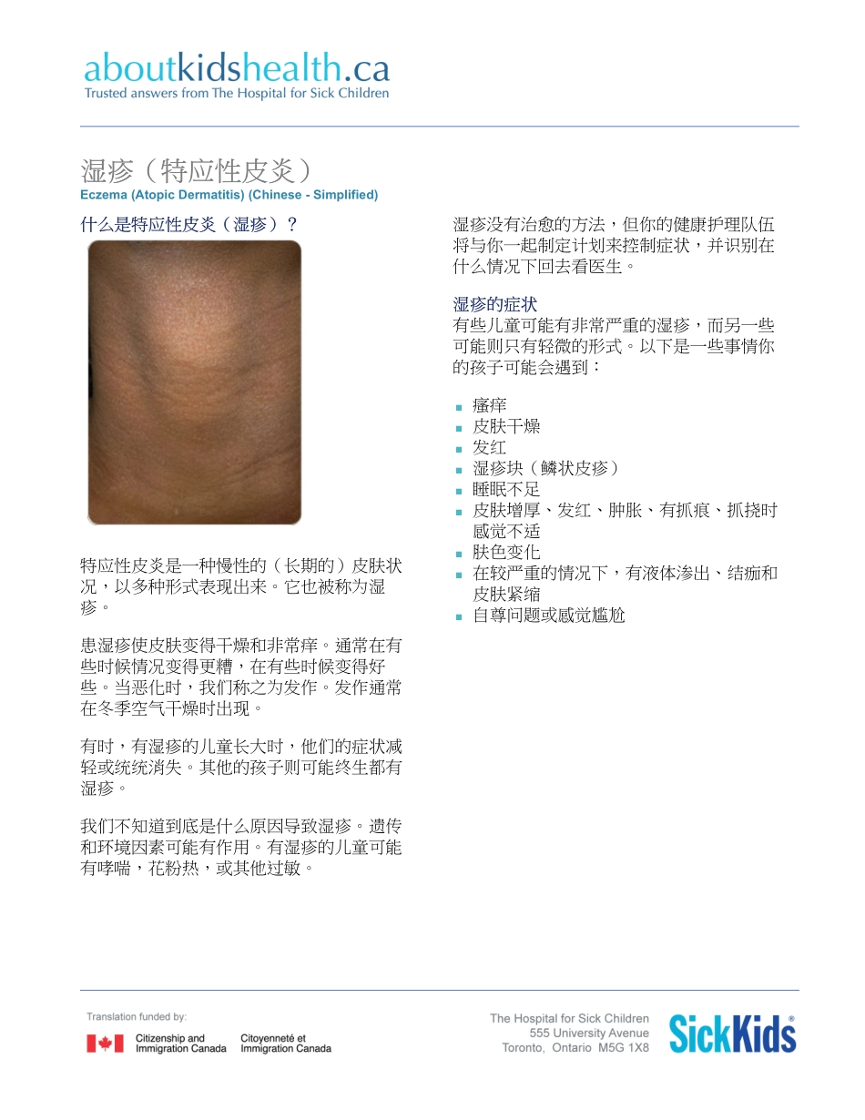 Eczema-atopic-dermatitis_湿疹_特应性皮炎_第1页