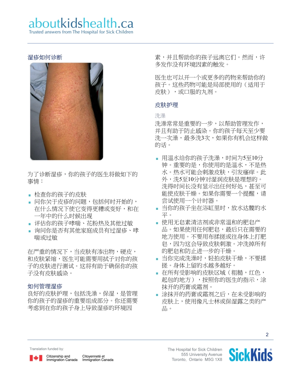 Eczema-atopic-dermatitis_湿疹_特应性皮炎_第2页