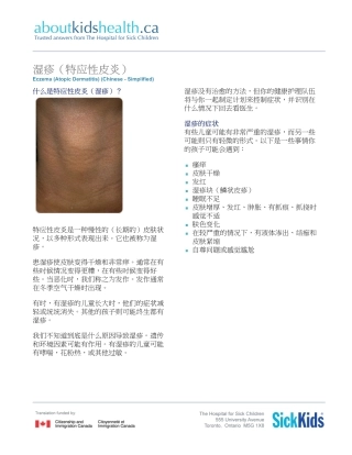 Eczema-atopic-dermatitis_湿疹_特应性皮炎