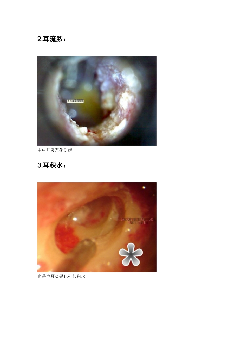 常见耳病治疗项目和操作_第2页