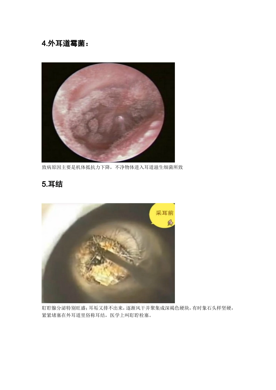 常见耳病治疗项目和操作_第3页
