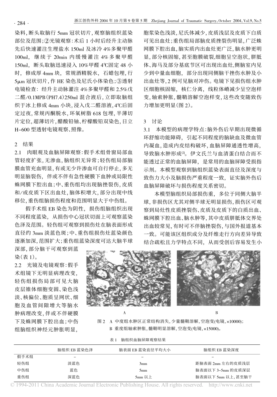 大鼠自由落体脑外伤模型的制作_高燕_第2页