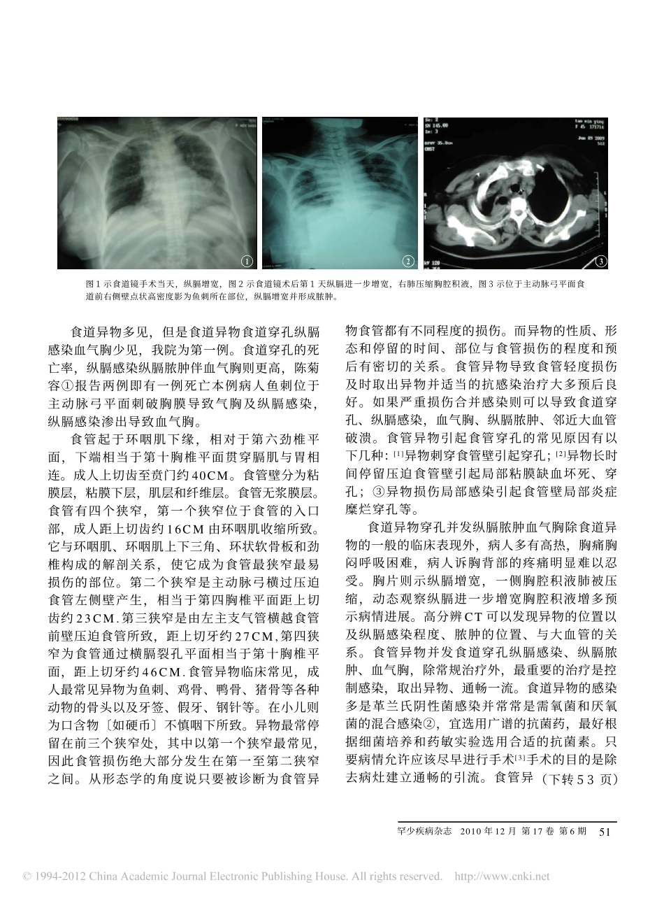 成功抢救食道异物穿孔伴纵膈脓肿血气胸一例_第2页