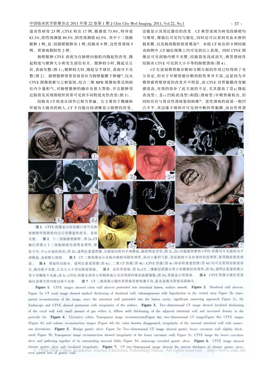 MSCT仿真内镜技术在胃肠道炎性病变诊断中的临床应用_第2页